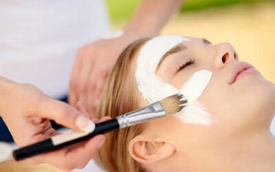What Should You Know Before Getting a Chemical Peel?