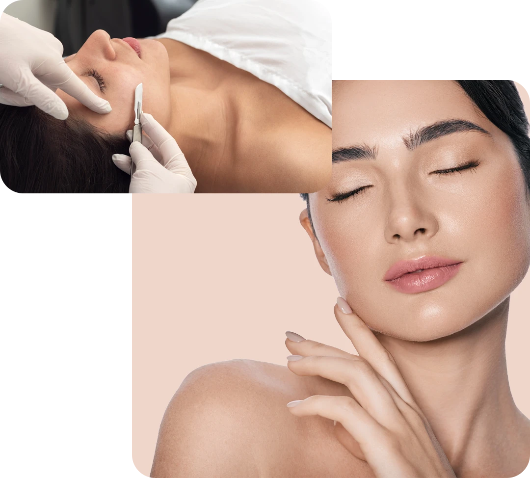 Dermaplaning Columbus Ohio