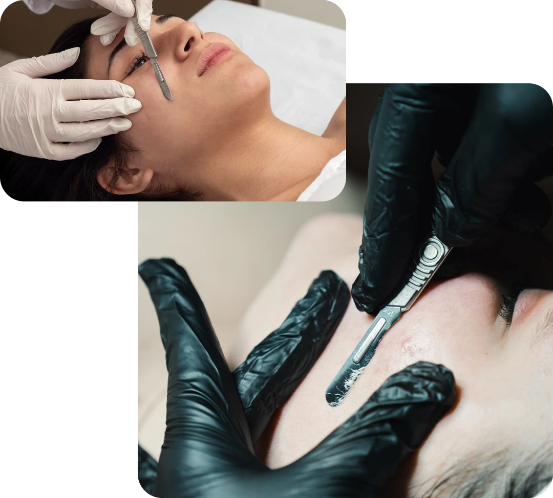 What to Expect During Your Treatment